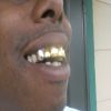 hooks
