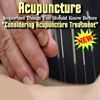 Acupuncture
